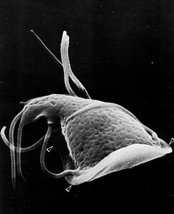 Worm-Human Parasite Giardia-gmtrop1.jpg