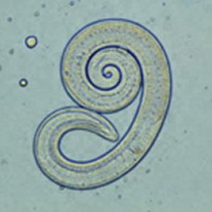 Trichinella larv1 DPDx - Trichinella spiralis.JPG