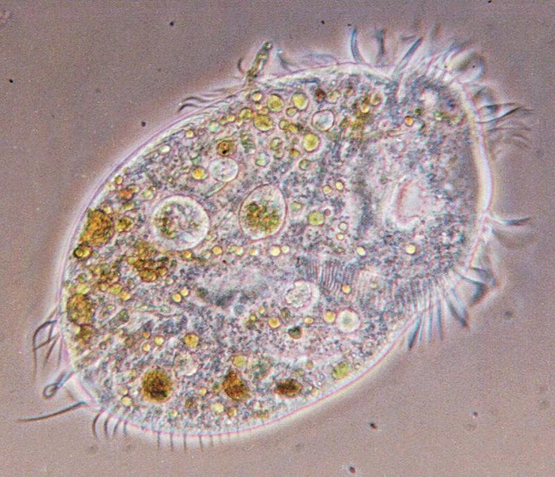 Euplotespha-Ciliate Protozoa-by Ralf Schmode.jpg