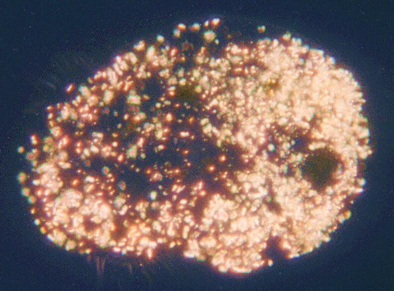 Euplotespol-Ciliate Protozoa-by Ralf Schmode.jpg