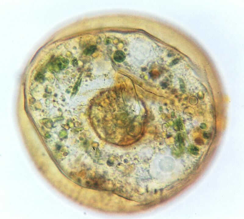 Arcella1-Amoebae-Protozoan-by Ralf Schmode.jpg
