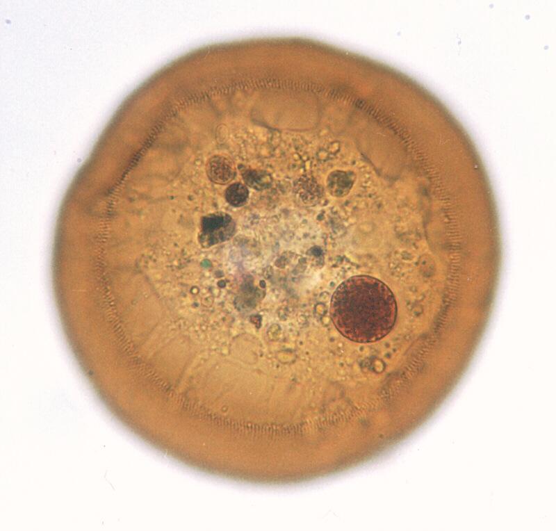Arcella2-Amoebae-Protozoan-by Ralf Schmode.jpg