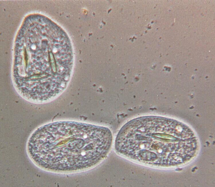 Ciliate 3cells-Protozoan-by Ralf Schmode.jpg