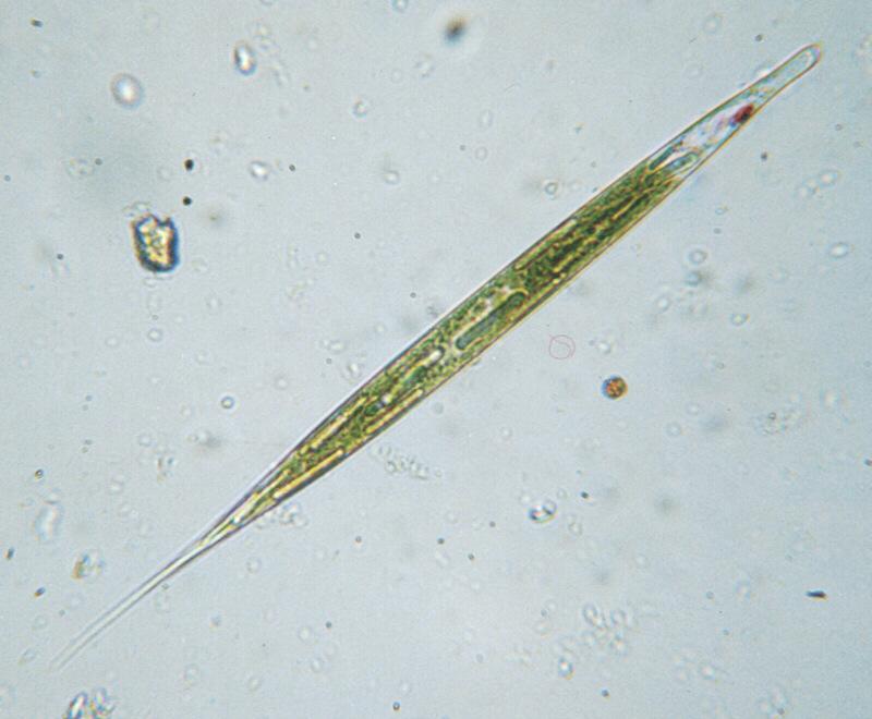 Euglena acus-Protozoan-by Ralf Schmode.jpg