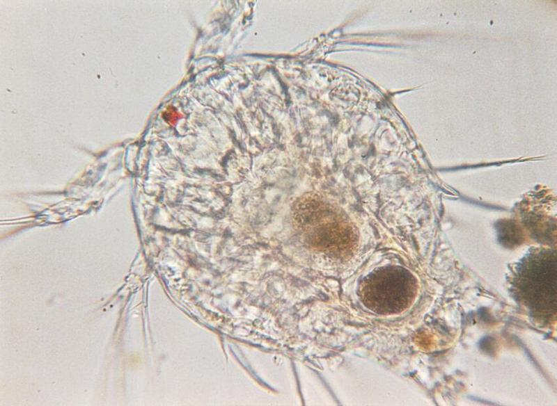 Nauplius3-Protozoan-Small aquatic crab s larva-by Ralf Schmode.jpg