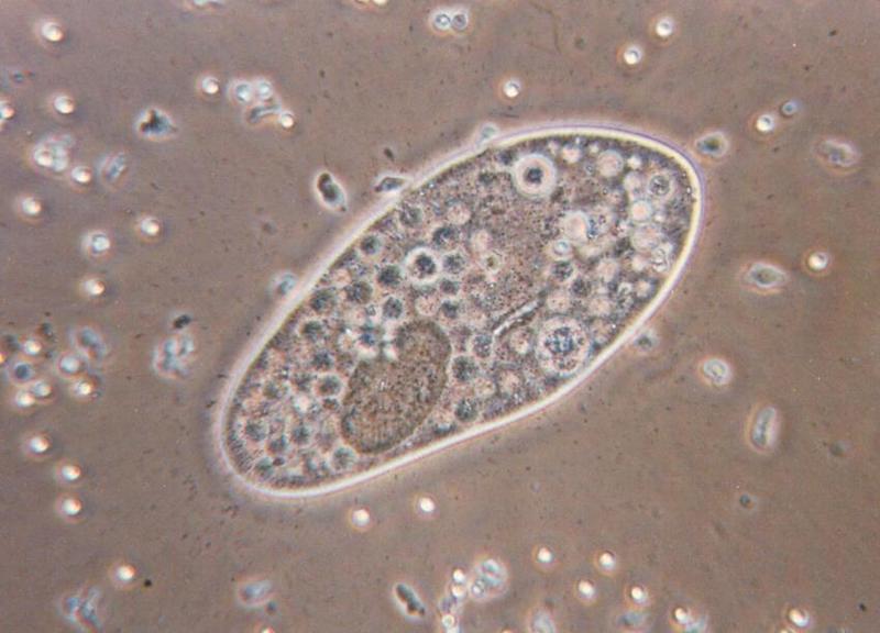 Paramecium caudatum 5-Protozoan-by Ralf Schmode.jpg