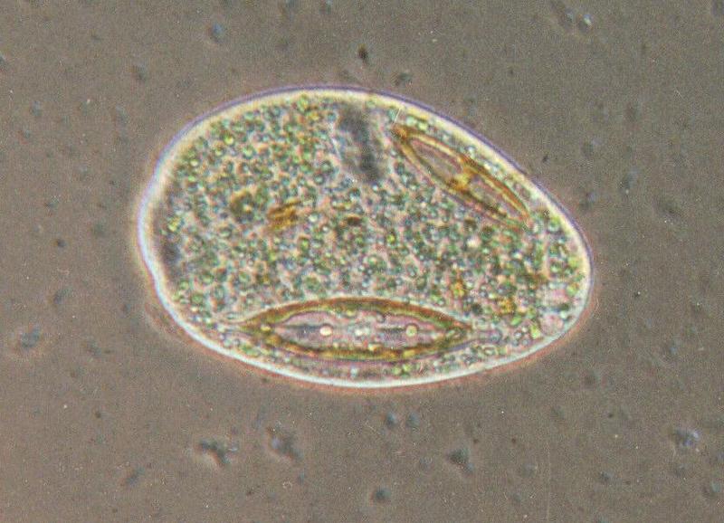 Prorodon-Protozoan ciliate-by Ralf Schmode.jpg