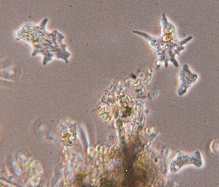 Protozoa-amoebae-by Ralf Schmode.jpg