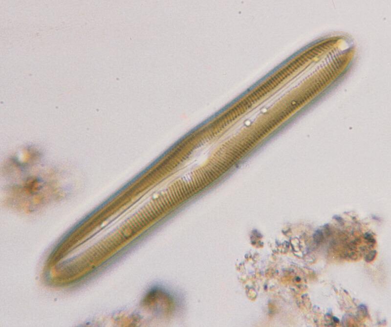 Protozoan-Pinnularia-by Ralf Schmode.jpg
